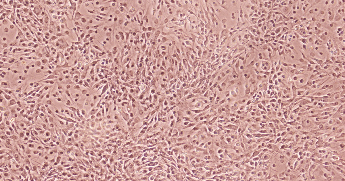 Emerging Methods In Biomarker Identification For Extracellular Vesicle ...