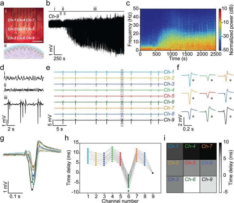 Figure 4: In vivo neural activity recordings with μPEA. a-(i) Optical image of...